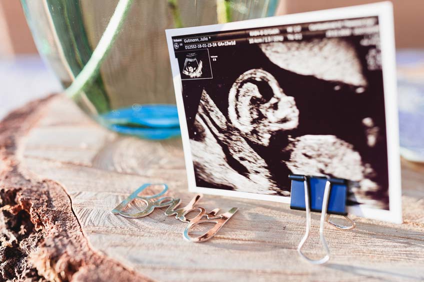 Dein Baby feiert mit! Ultraschallbilder sind eine tolle Deko und übermitteln die Frohe Botschaft © juliafashionblonde Dein Baby feiert mit! Ultraschallbilder sind eine tolle Deko und übermitteln die Frohe Botschaft © juliafashionblonde